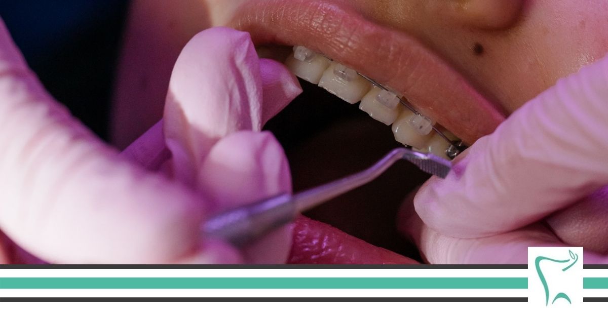 Ortodoncja – sekret pięknego i zdrowego uśmiechu