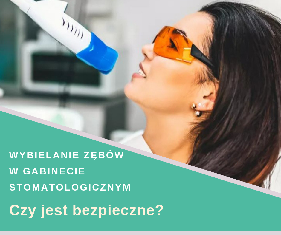 Wybielanie zębów w gabinecie stomatologicznym Wybielanie zębów w gabinecie stomatologicznym