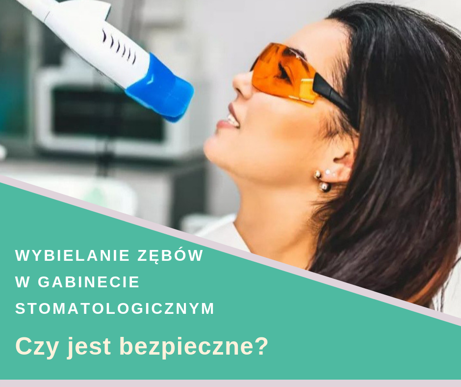 Wybielanie zębów w gabinecie stomatologicznym