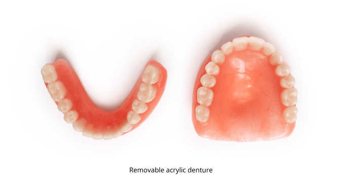 Removable acrylic denture proteza-akrylowa.png