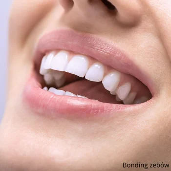 Bonding zębów – szybka i bezpieczna metamorfoza uśmiechu
